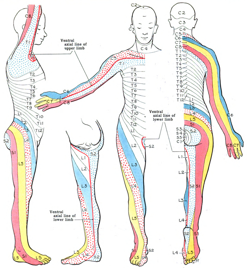 Lensemble de la gymnastique à lombaire osteokhondroze avec les images