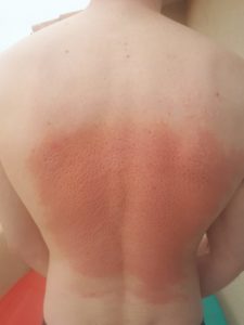 effet du champs de fleurs sur la peau